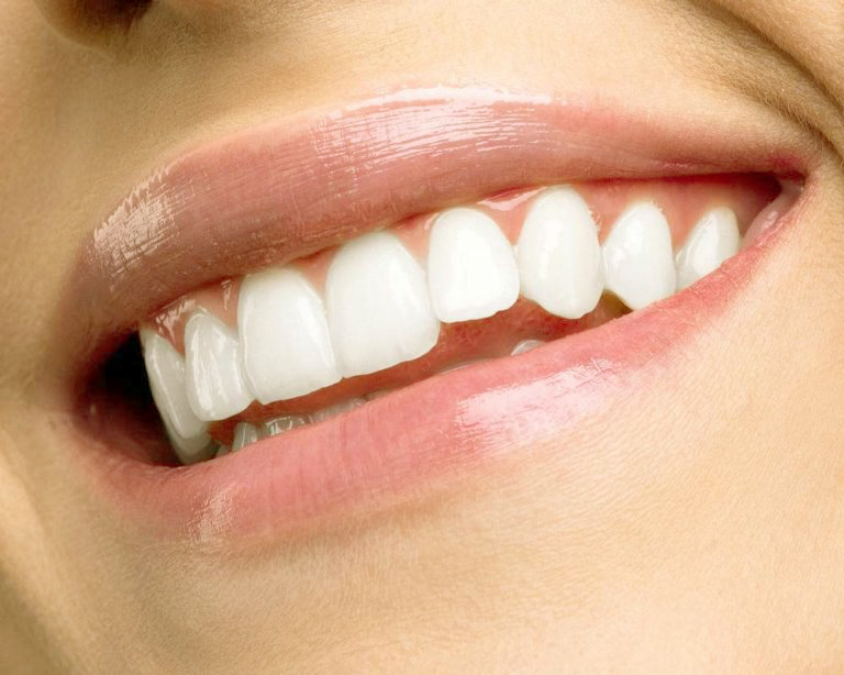 Teeth-whitening-768x614